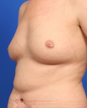 Case # 40 before photo