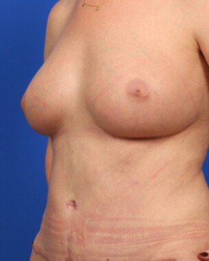 Case # 40 after photo