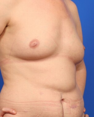 Case # 40 before photo