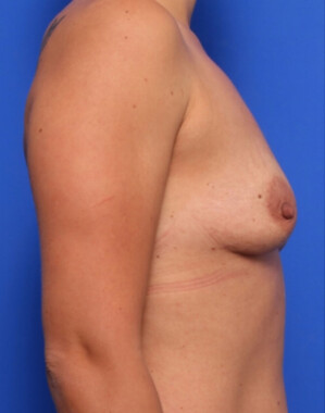 Case # 139 before photo