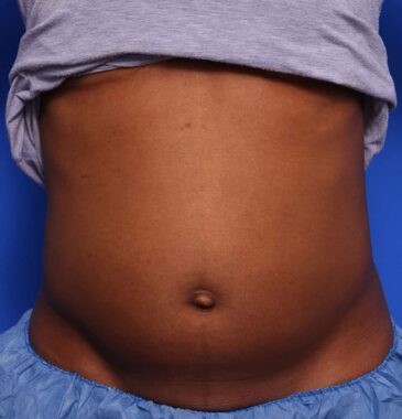 Case # 12 before photo