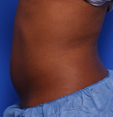 Case # 12 before photo