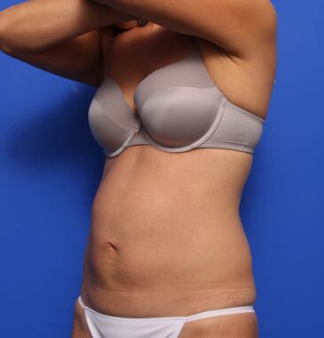 Case # 15 after photo