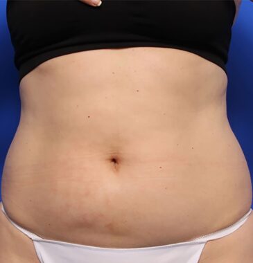 Case # 17 before photo