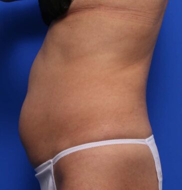 Case # 23 before photo