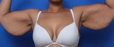 Case # 1 before photo