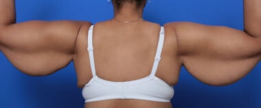 Case # 1 before photo