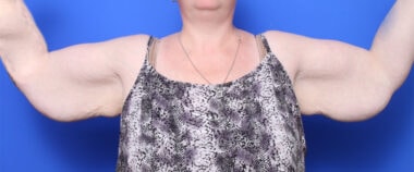 Case # 3 before photo