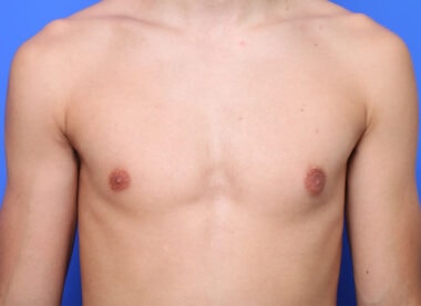 Case # 1 after photo