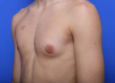 Case # 1 before photo