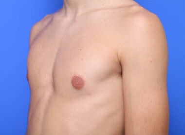 Case # 1 after photo