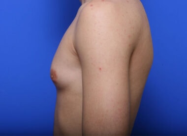 Case # 1 before photo