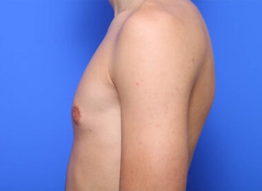 Case # 1 after photo