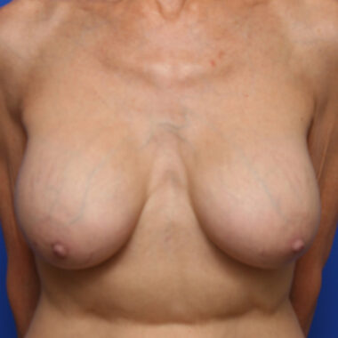 Case # 16 after photo