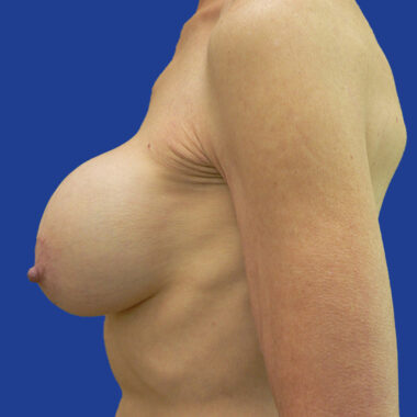 Case # 16 before photo