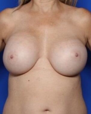 Case # 3 before photo