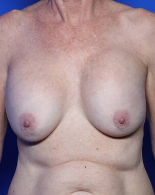 Case # 8 before photo