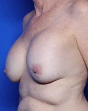 Case # 8 before photo