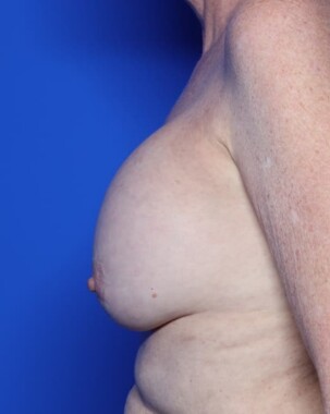 Case # 8 before photo