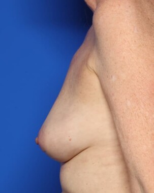 Case # 8 after photo