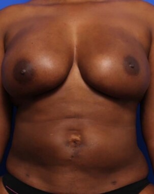 Case # 25 after photo