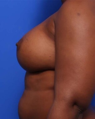 Case # 25 before photo