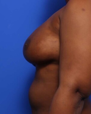 Case # 25 after photo