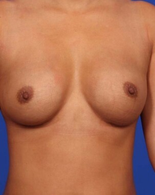 Case # 11 after photo