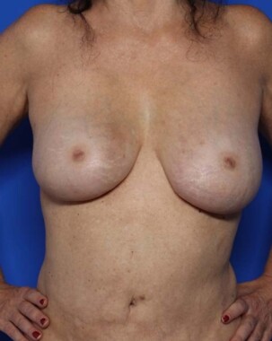 Case # 17 after photo