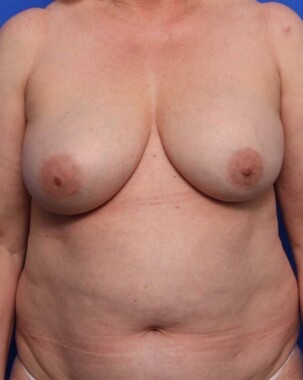 Case # 18 before photo