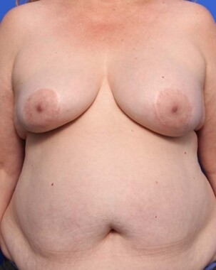 Case # 19 before photo