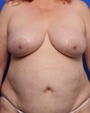 Case # 19 after photo