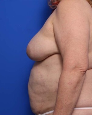 Case # 19 after photo