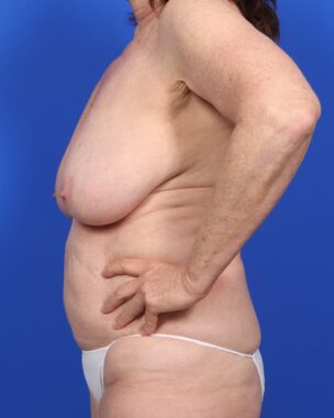 Case # 13 before photo