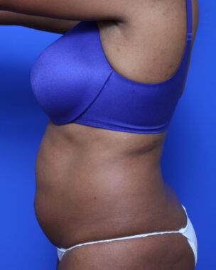 Case # 2 before photo