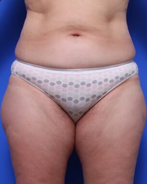 Case # 12 before photo