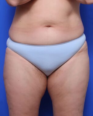 Case # 12 after photo