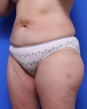 Case # 12 before photo