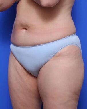 Case # 12 after photo