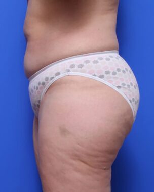 Case # 12 before photo